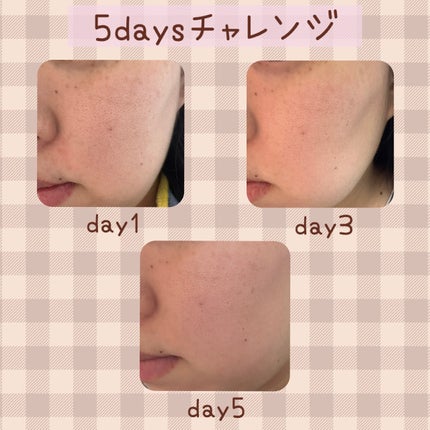 リードルS PDRN+ セラム/VT/美容液を使ったクチコミ(2枚目)