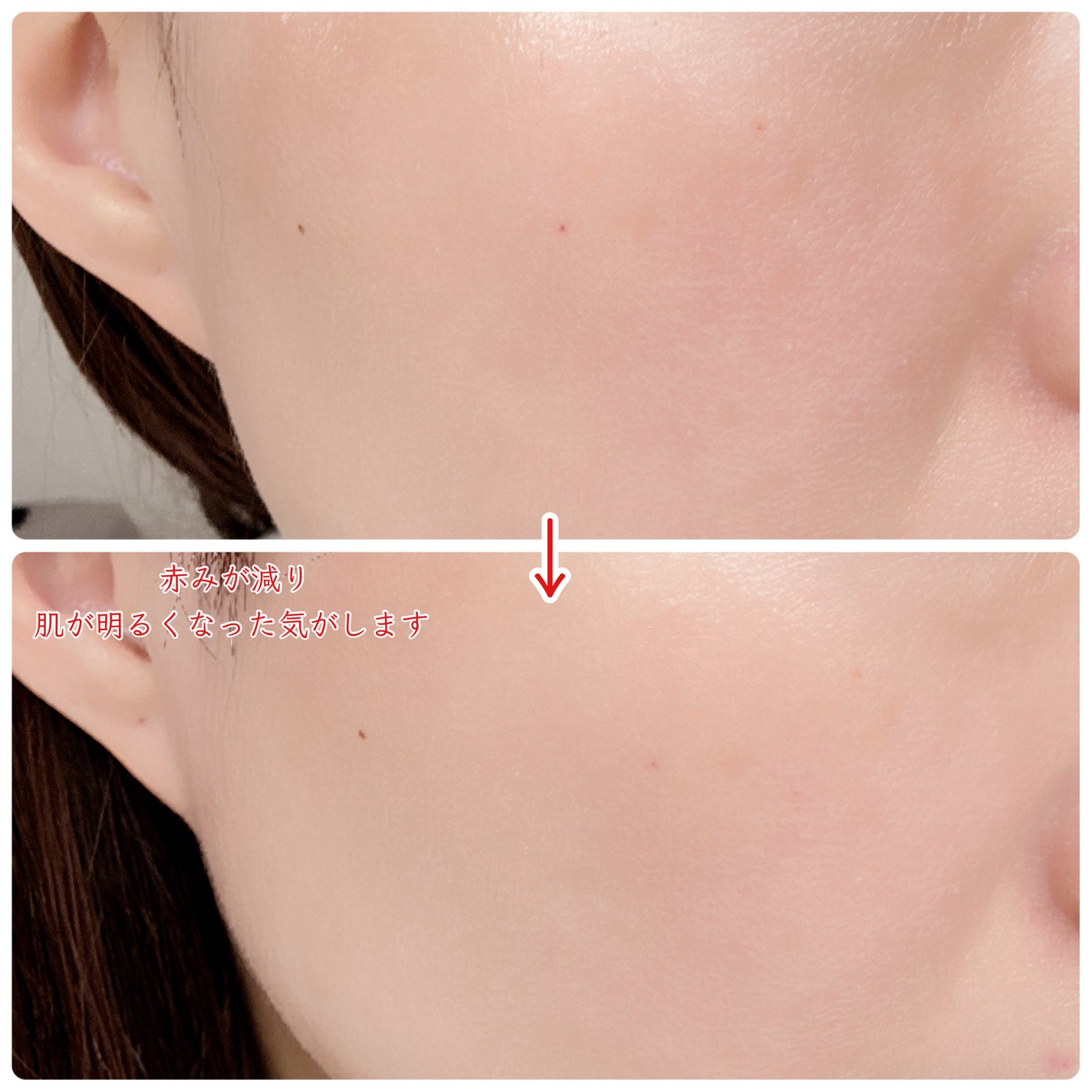 みあ◡̈ フォロバ100 on LIPS 「#PR毎日3分ポテンツァとして出たメディテラピーの新作❤️⋆⸜..」(3枚目)