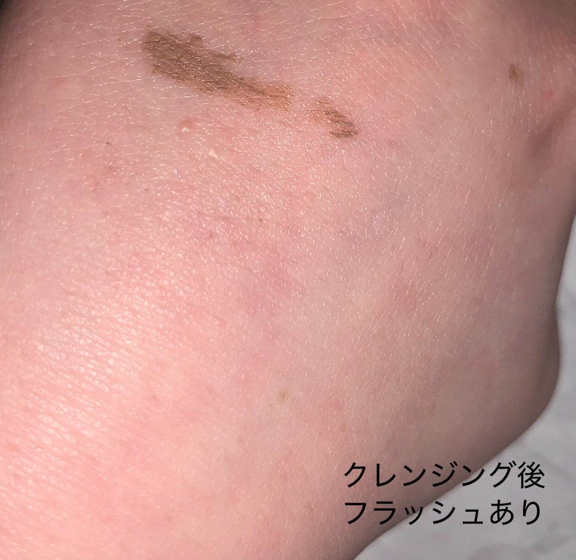 DHC ディープ クレンジング バーム/DHC/クレンジングバームを使ったクチコミ(6枚目)