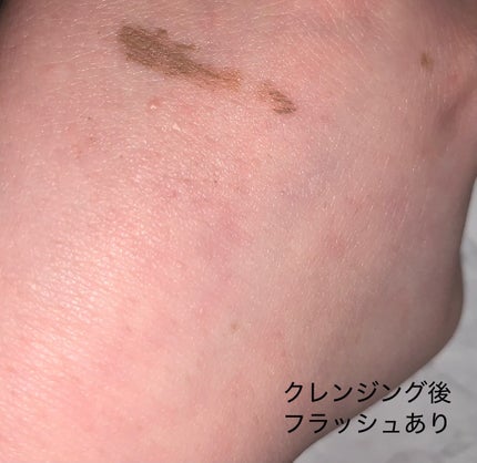 DHC ディープ クレンジング バーム/DHC/クレンジングバームを使ったクチコミ(6枚目)