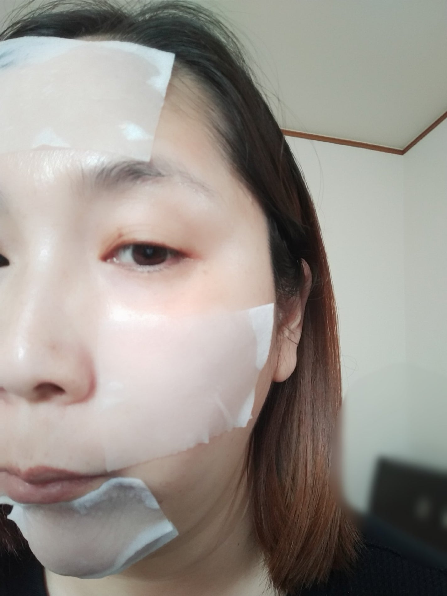 ノープロブレムスポットソフトナー/ilso/その他スキンケアを使ったクチコミ(5枚目)