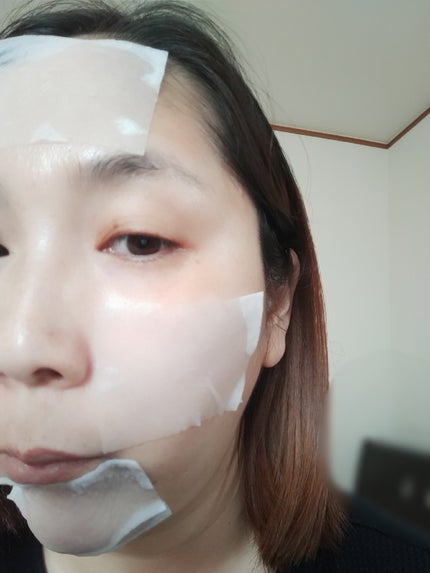 ノープロブレムスポットソフトナー/ilso/その他スキンケアを使ったクチコミ(5枚目)