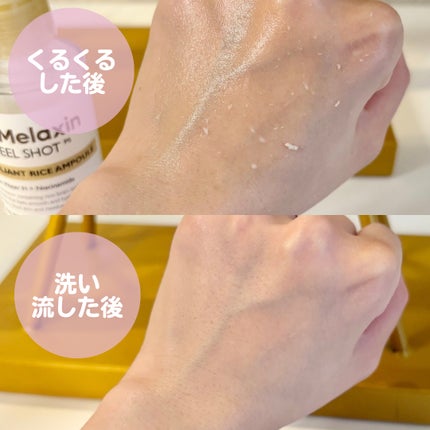 白米ピールショットゴマージュアンプル/Dr.Melaxin/美容液を使ったクチコミ(7枚目)