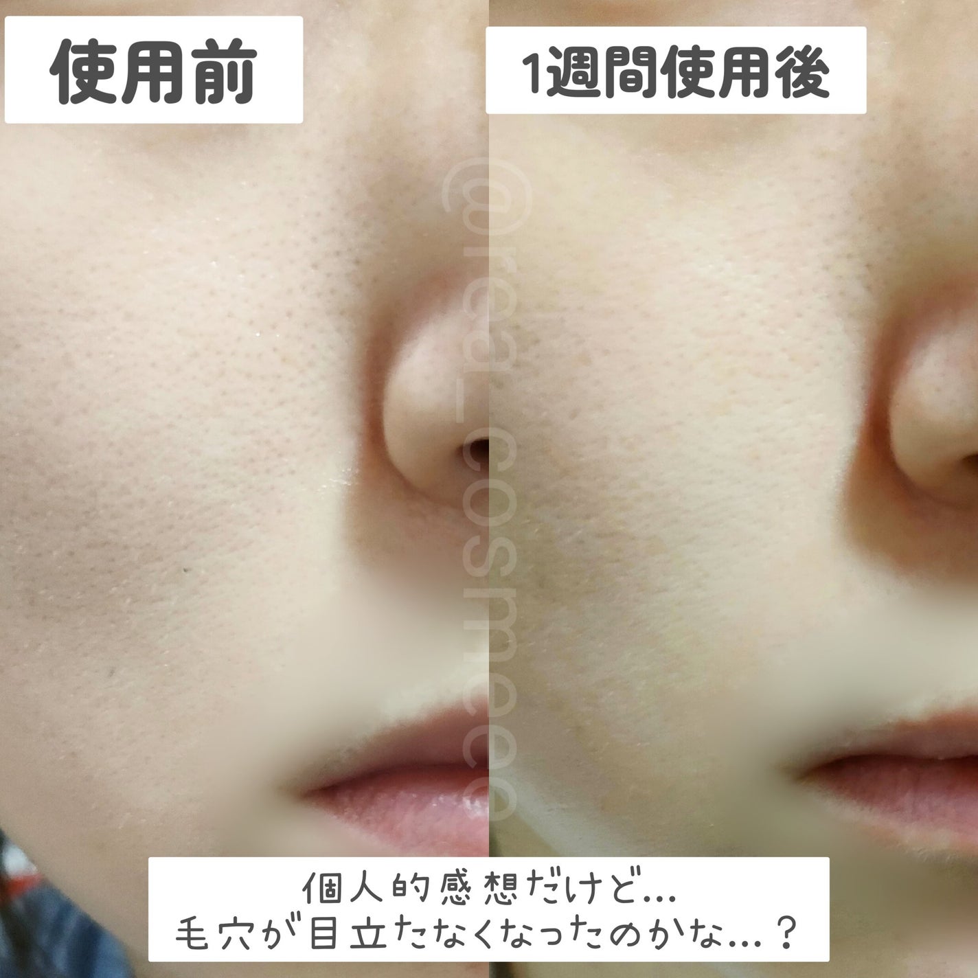 A1カーミング アンプル/VT/美容液を使ったクチコミ(5枚目)