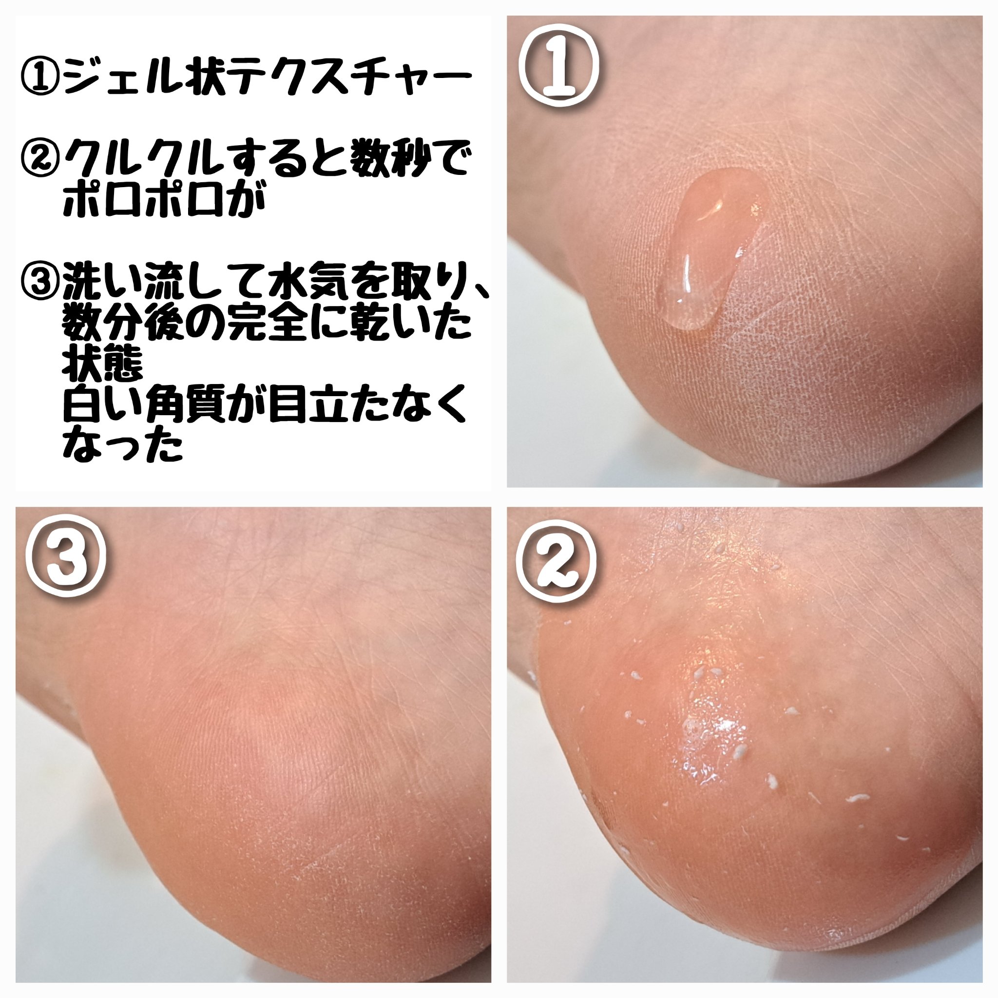 ナチュラルアクアジェル/Cure/ピーリングを使ったクチコミ（3枚目）