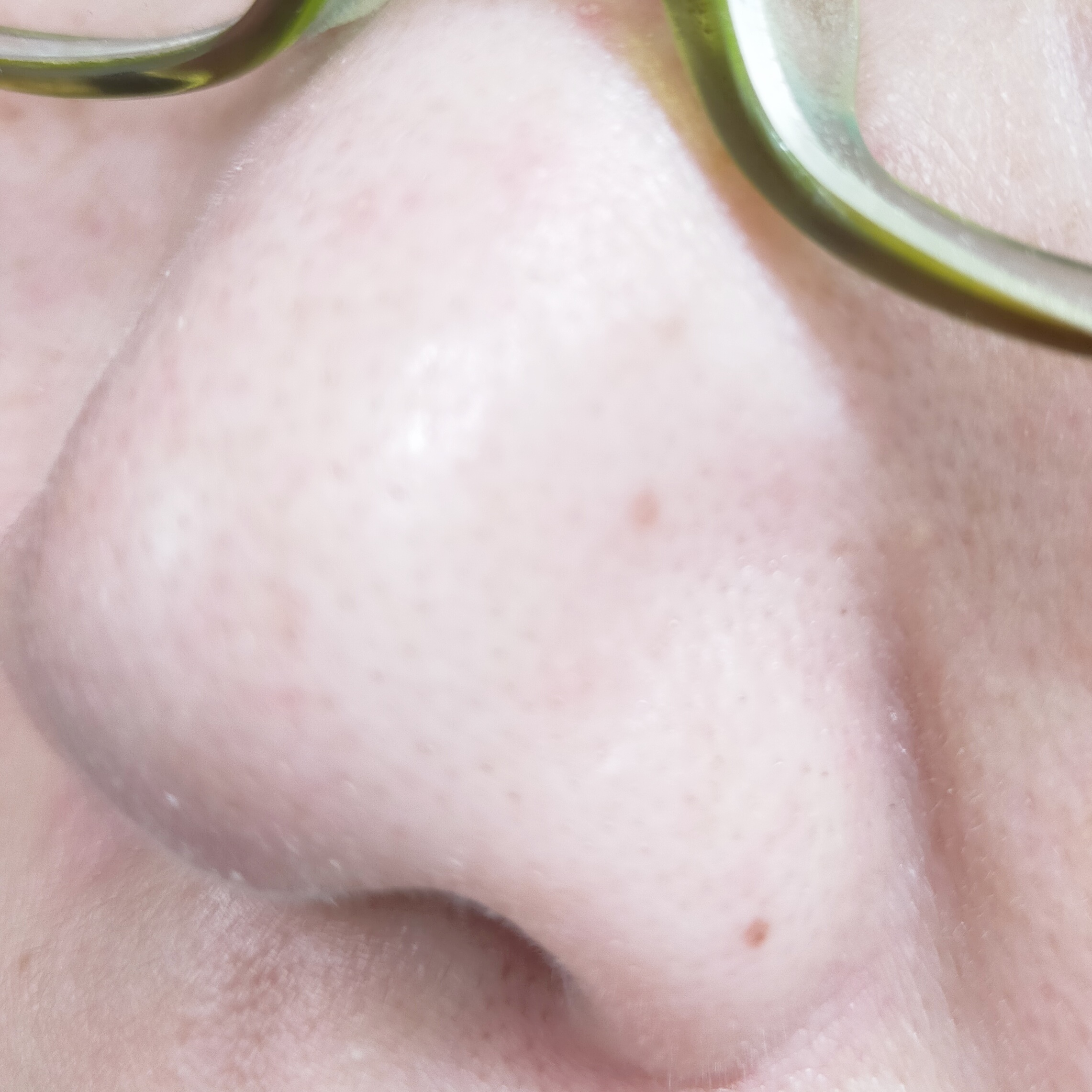 A1カーミング アンプル/VT/美容液を使ったクチコミ（3枚目）