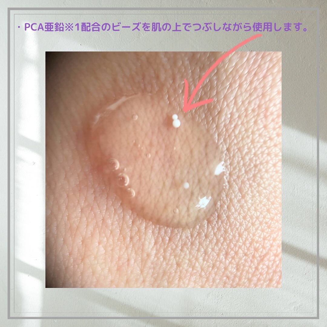 ナイアシンジンクビーズセラム/Frankly/美容液を使ったクチコミ（2枚目）