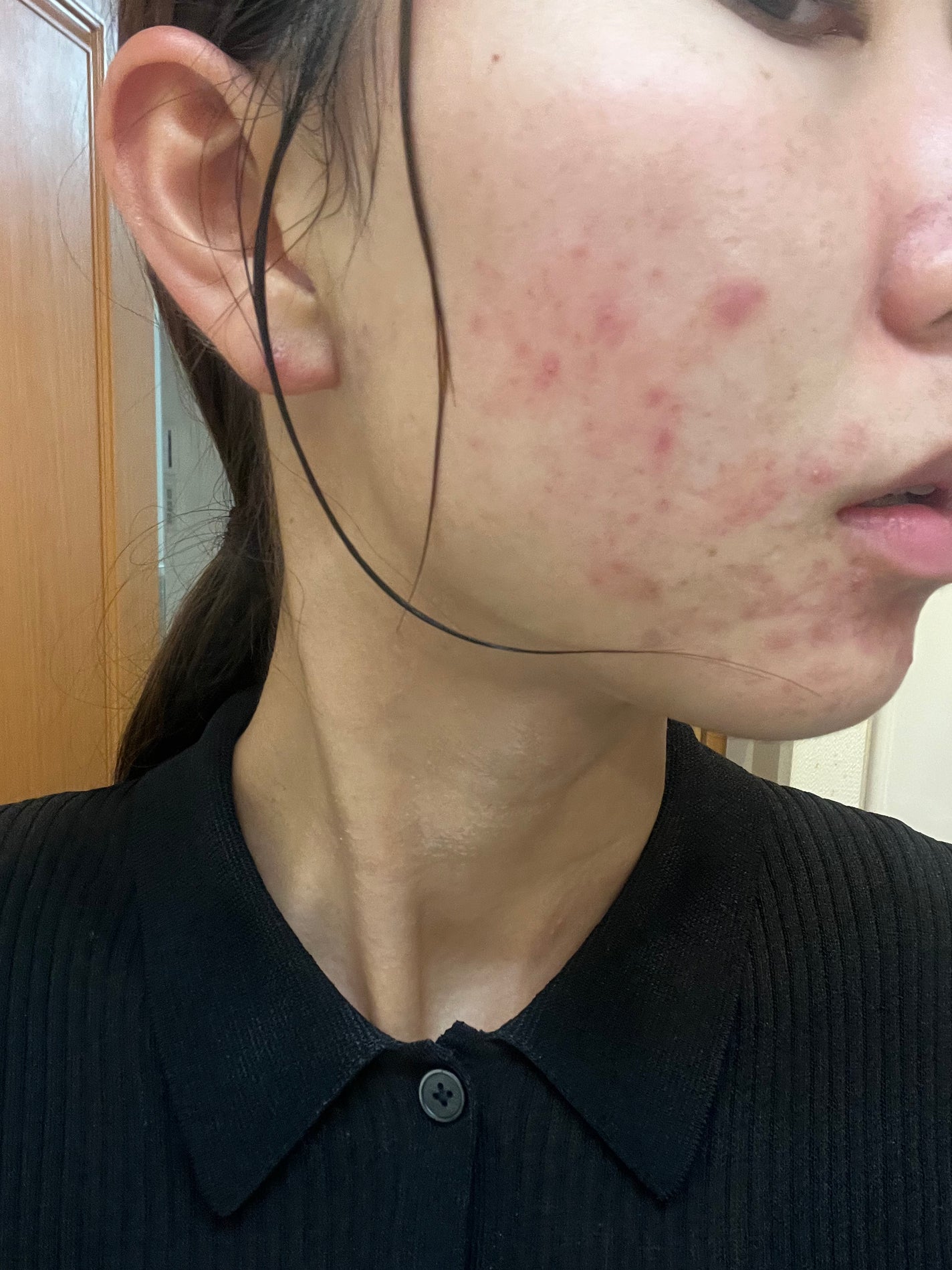 白潤プレミアム 薬用浸透美白乳液/肌ラボ/乳液を使ったクチコミ(4枚目)