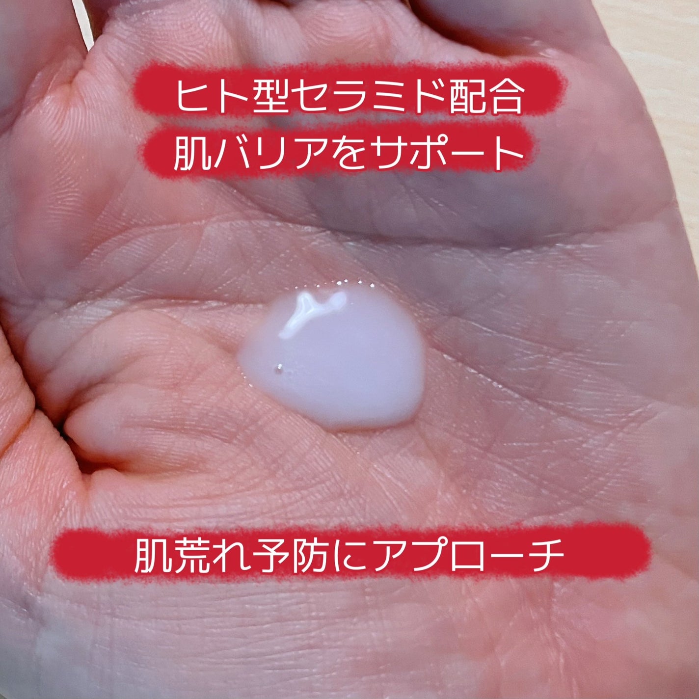 モイスチャーマトリックスNS/シェルシュール/美容液を使ったクチコミ(3枚目)