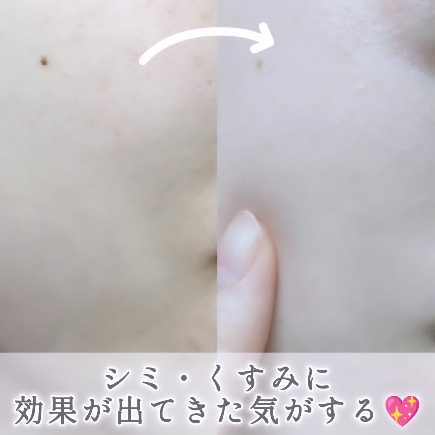 トラネキサム酸スキンブースタークリーム/MEDITHERAPY/フェイスクリームを使ったクチコミ（3枚目）