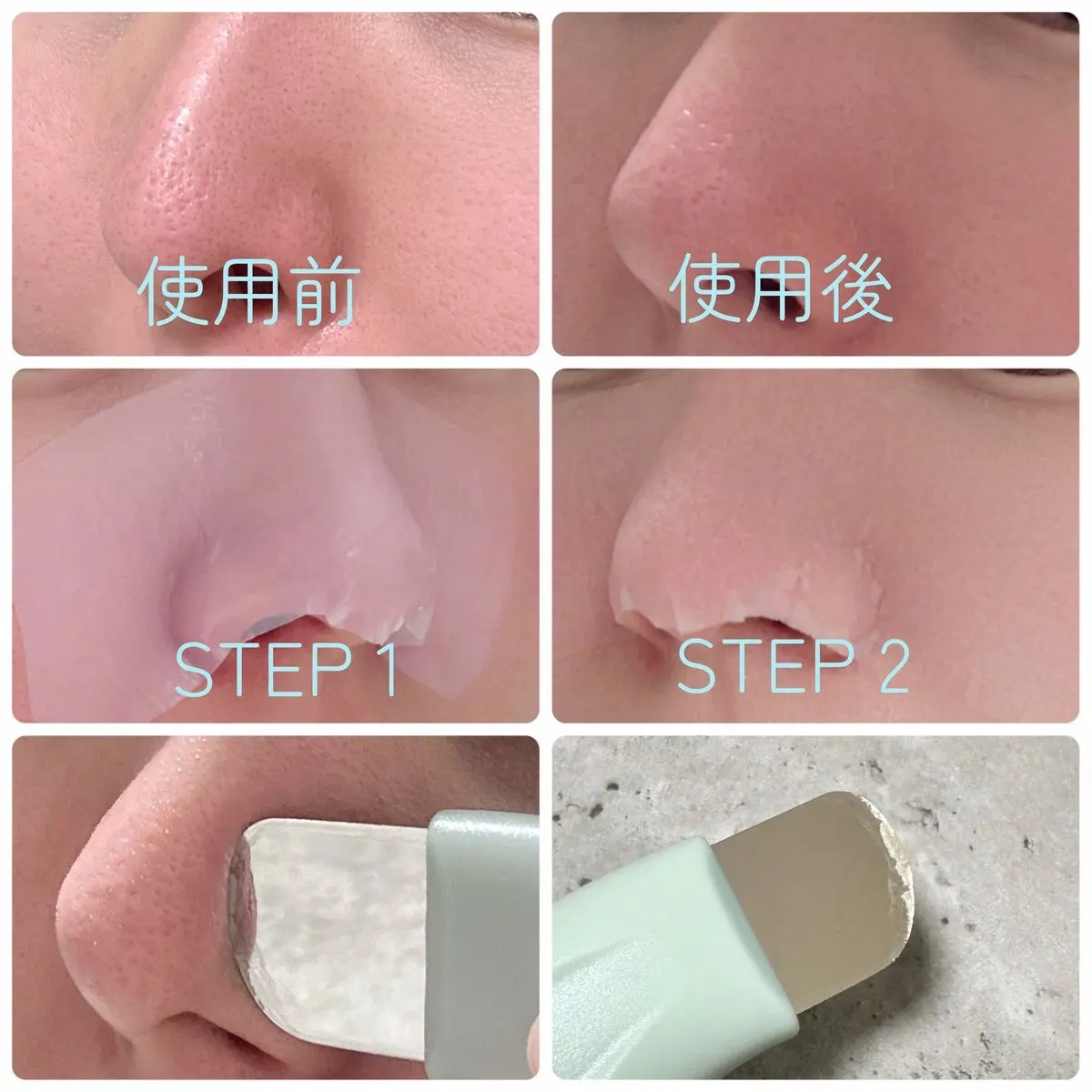 ILSO NATURAL MILD CLEAR NOSE PACK (DONKI 限定)/ilso/その他キットセットを使ったクチコミ（2枚目）