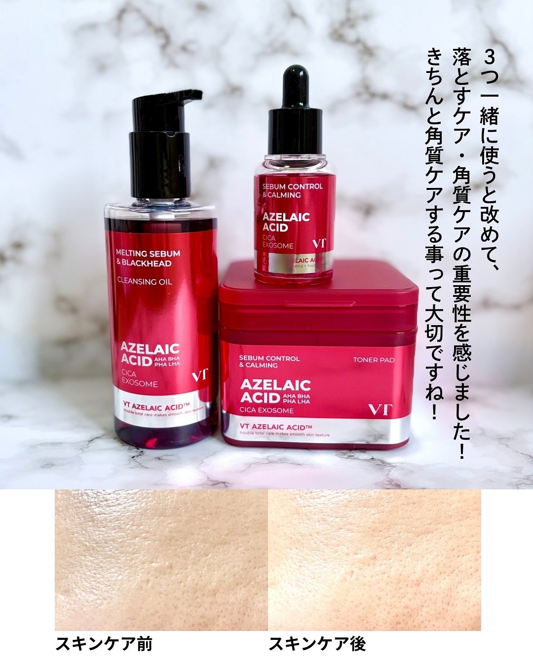 小籠包ちゃん フォロバ100% on LIPS 「\乾燥肌でもOK!アゼライン酸神器/VTCOSMETICS@v..」(6枚目)