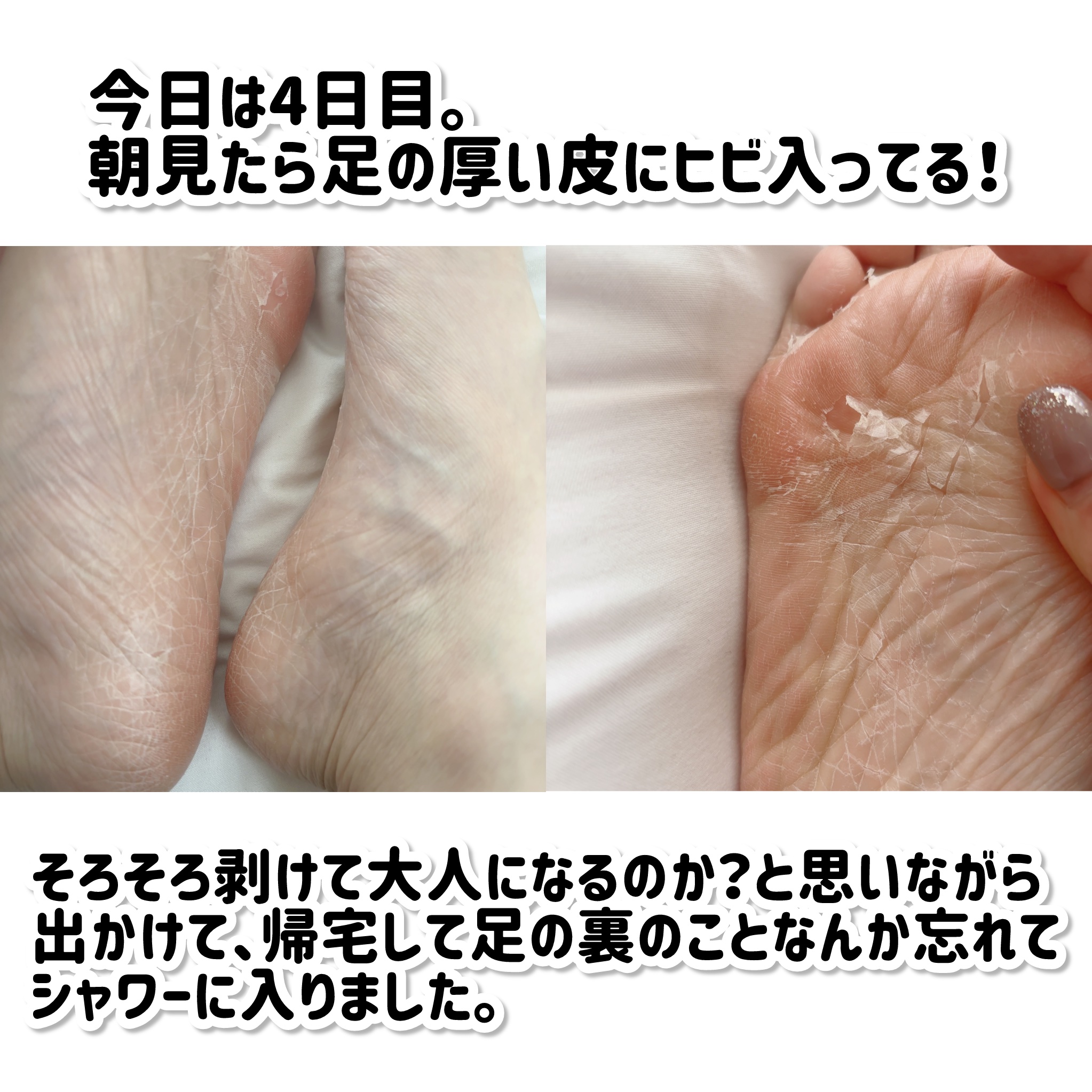 ましゅまろ素足/ピコモンテ/レッグ・フットケアを使ったクチコミ（3枚目）