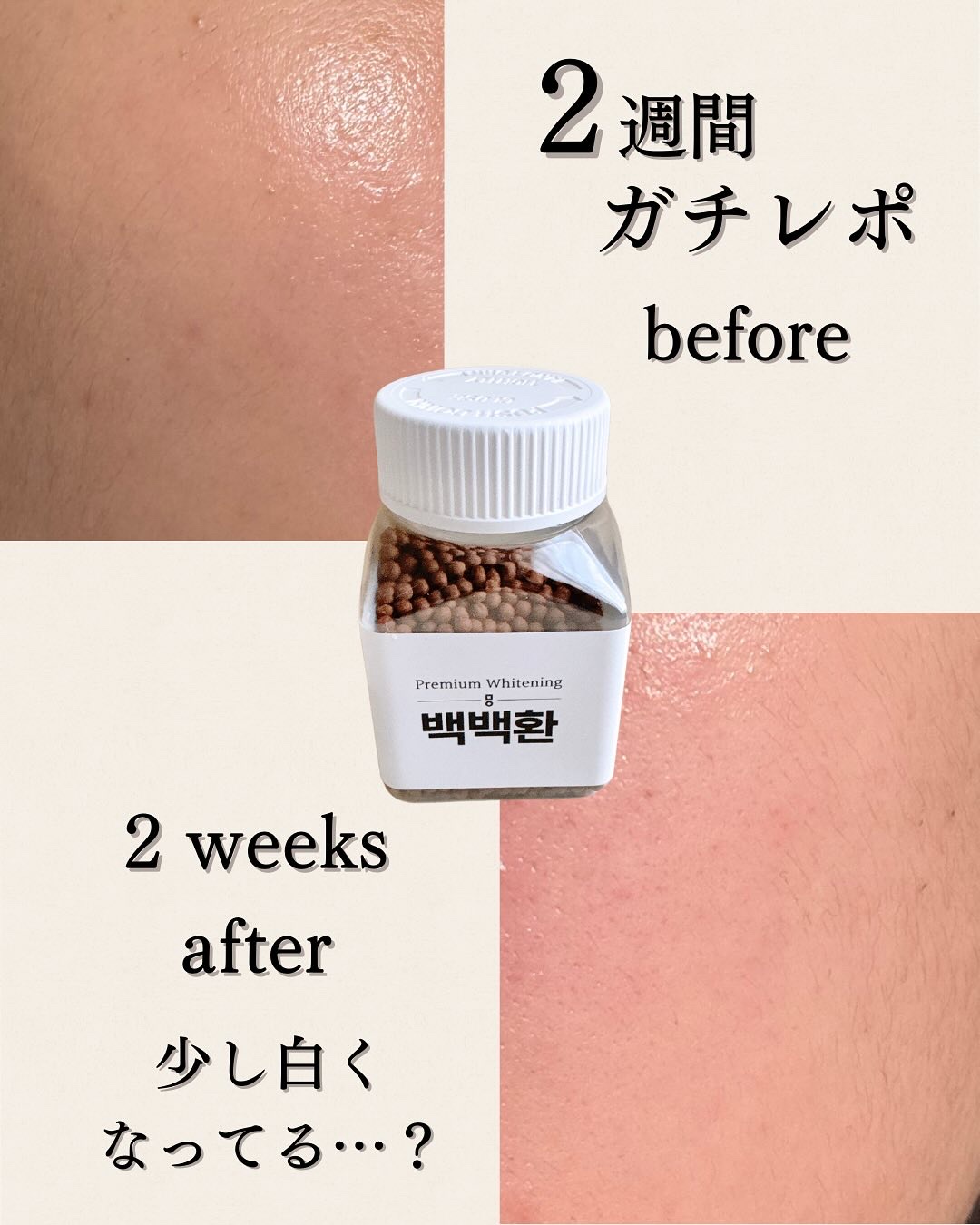 白白丸/ミオル韓医院/美容サプリメントを使ったクチコミ（3枚目）