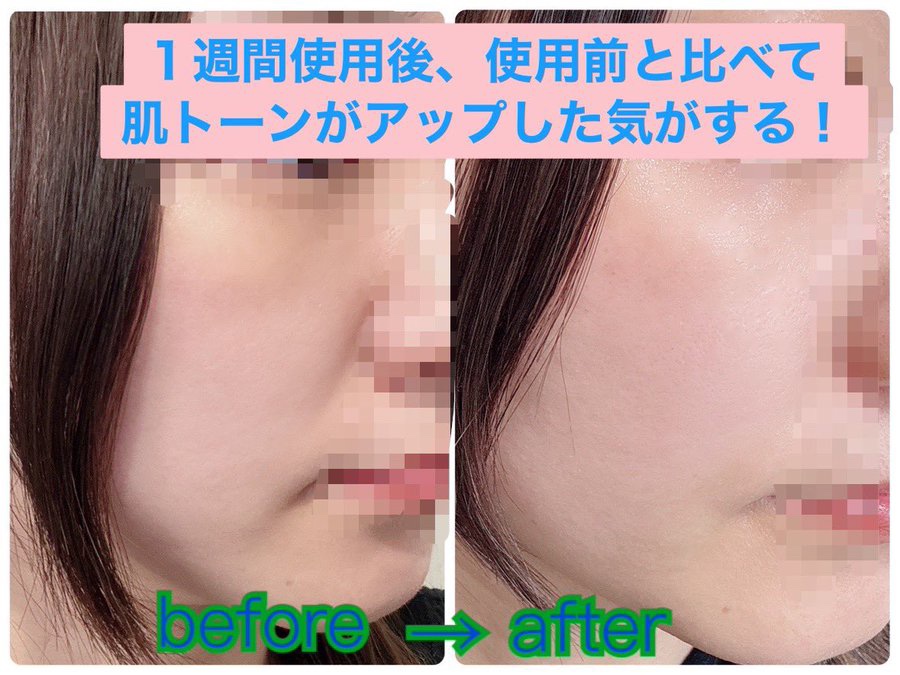 トラネキサム酸スキンブースタークリーム/MEDITHERAPY/フェイスクリームを使ったクチコミ（2枚目）