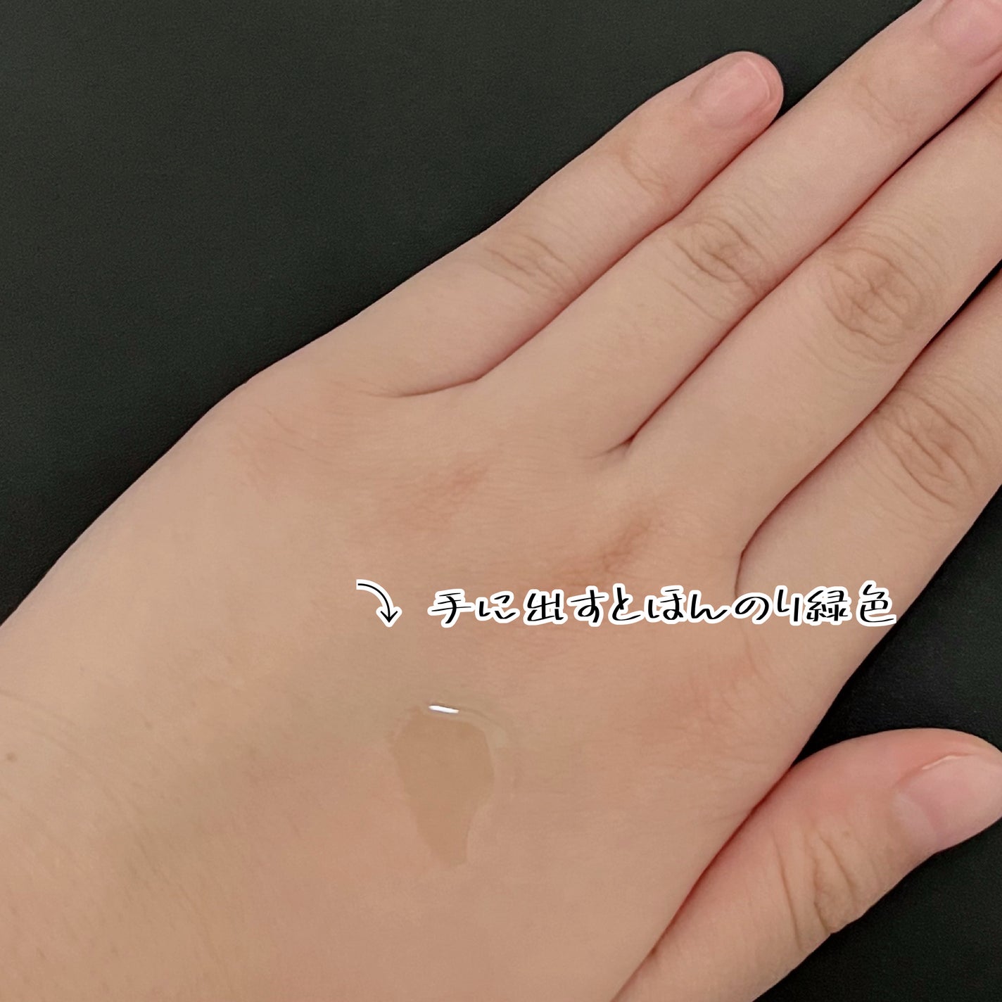 アゼライン酸15 インテンスカーミングセラム/Anua/美容液を使ったクチコミ(3枚目)