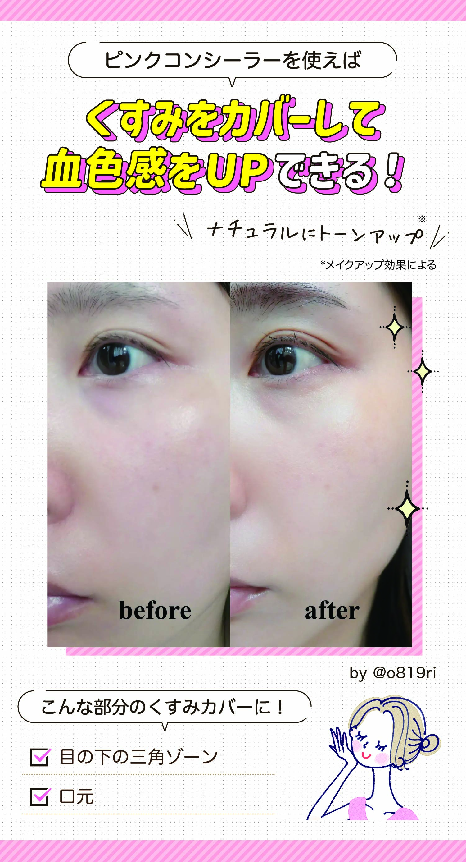 ピンクコンシーラーを使えばくすみをカバーして血色感をUPできる！ナチュラルにトーンアップ*。目の下の三角ゾーンや口元のくすみカバーにおすすめ！*メイクアップ効果による