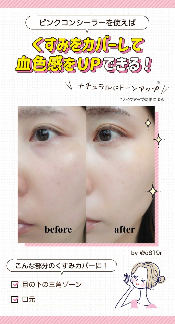 ピンクコンシーラーを使えばくすみをカバーして血色感をUPできる!ナチュラルにトーンアップ*。目の下の三角ゾーンや口元のくすみカバーにおすすめ!*メイクアップ効果による