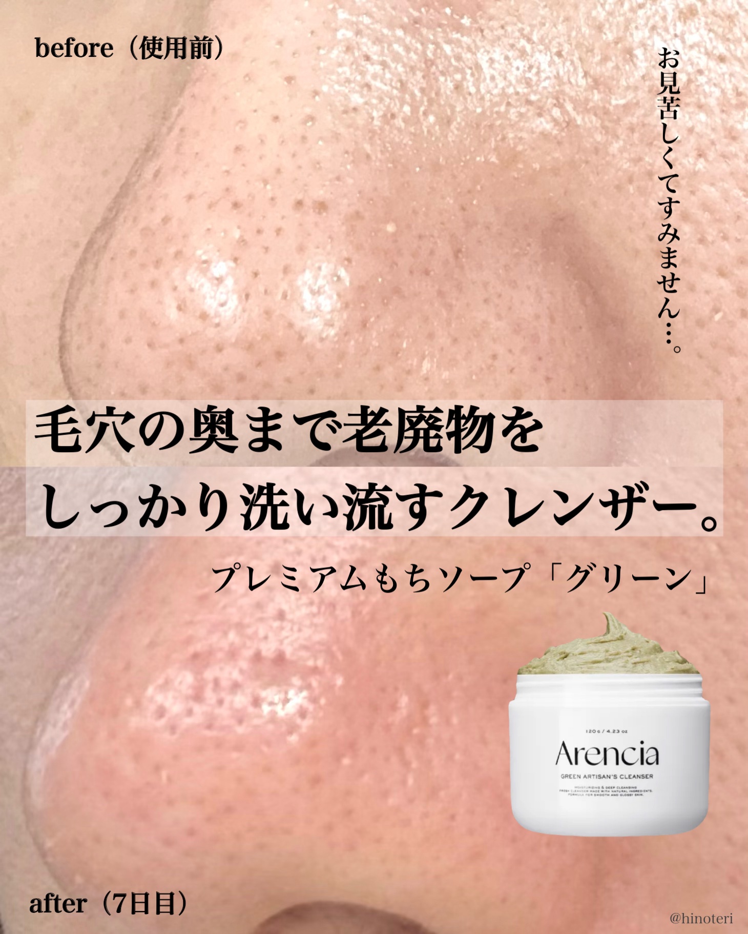 ．
．
．
プレミアムもちソープ「グリーン」

もちっとしたテクスチャーが特徴の絶品「モチソープ」。
今回Qoo10のビューティーランキングで1位を獲得。
ついに日本全域での展開を開始し@cosmeやLoftを皮切りに500店舗での販売を販