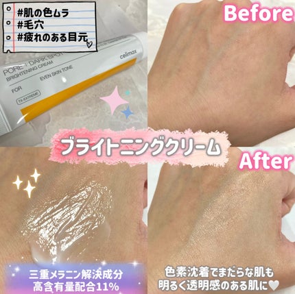 ポア ブライトニング シミケアセラム/celimax/美容液を使ったクチコミ(5枚目)