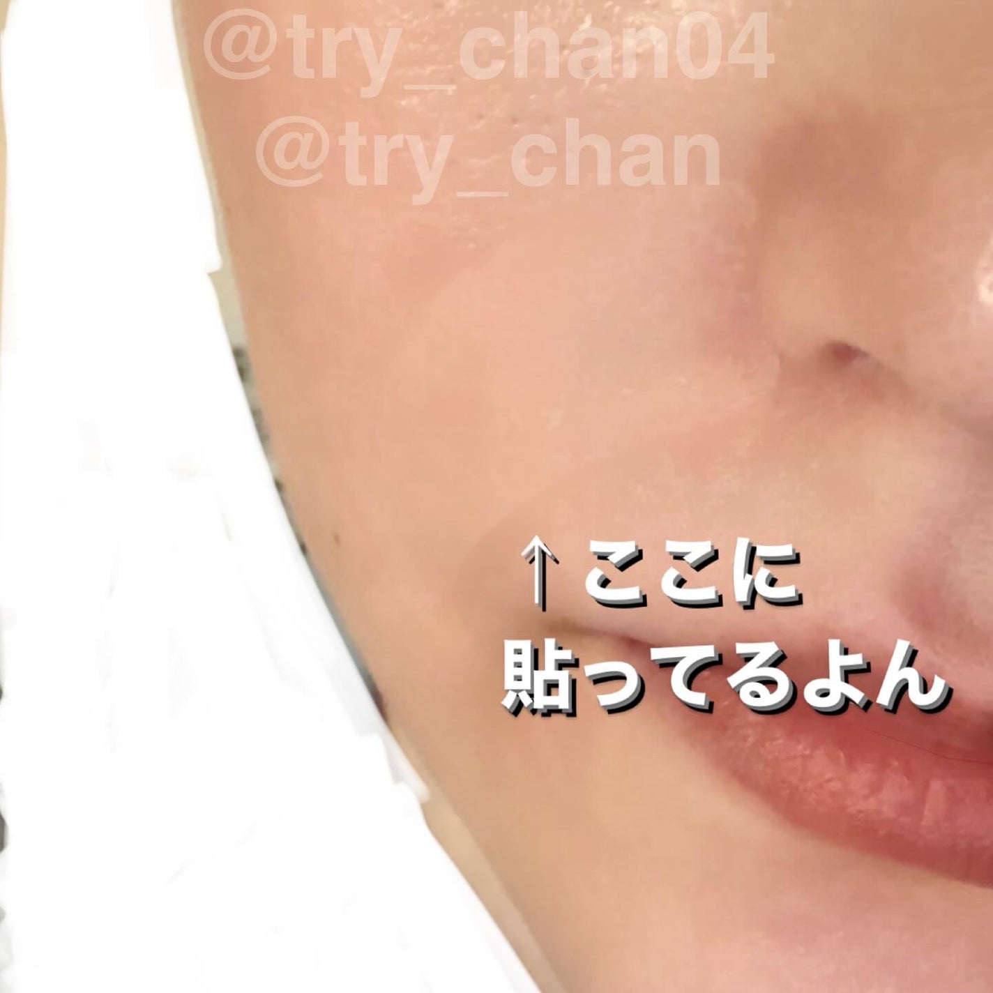 リンクルマスターパッチ | T-zone/MADFORCOS/シートマスク・パックを使ったクチコミ(6枚目)