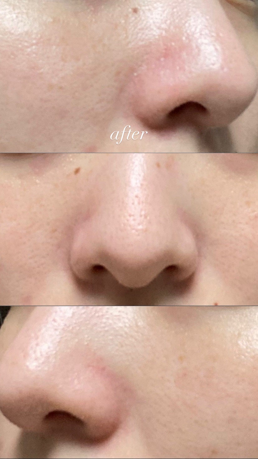 AZケア クレンジングオイル/VT/オイルクレンジングを使ったクチコミ(3枚目)