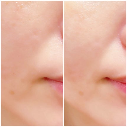 A1カーミング アンプル/VT/美容液を使ったクチコミ(10枚目)