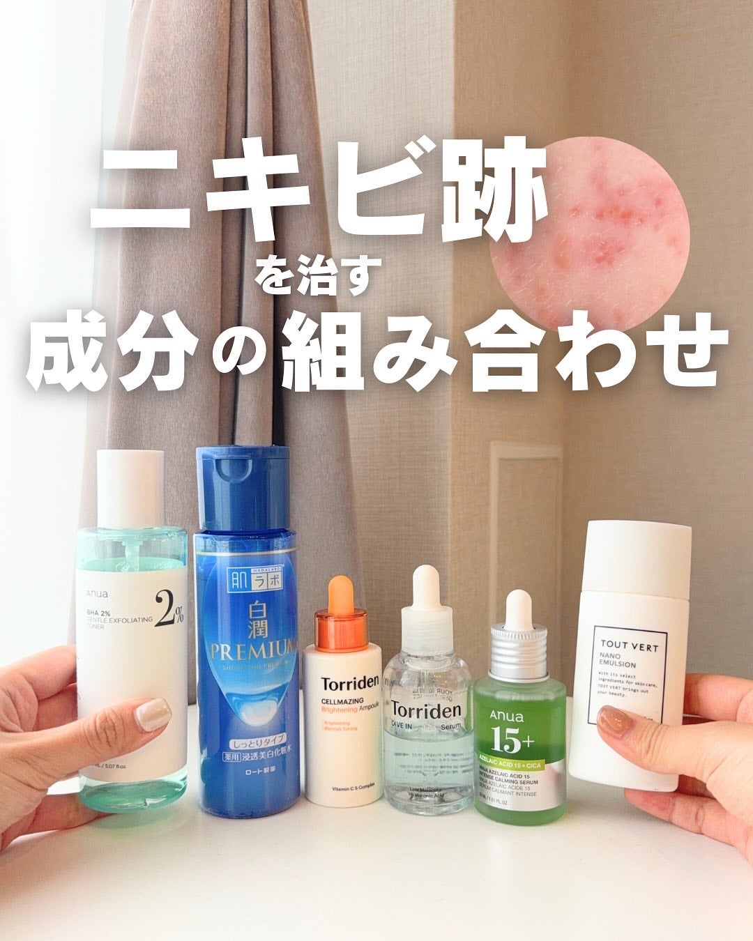 白湯(サユ) | ニキビと戦うOL🤍 on LIPS 「・白湯です!ニキビ跡がなかなか綺麗に治らなくてコンシーラーを手..」(1枚目)