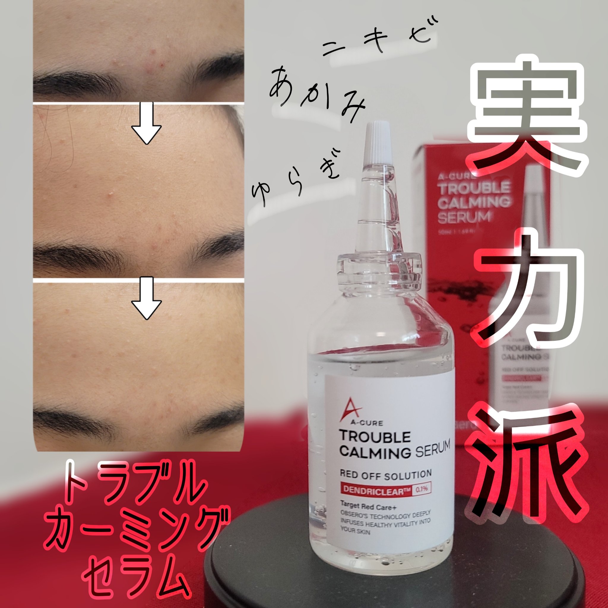 エーキュアトラブルカーミングセラム/obsero/美容液を使ったクチコミ（1枚目）