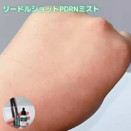 リードルS PDRN+ セラム/VT/美容液を使ったクチコミ(4枚目)