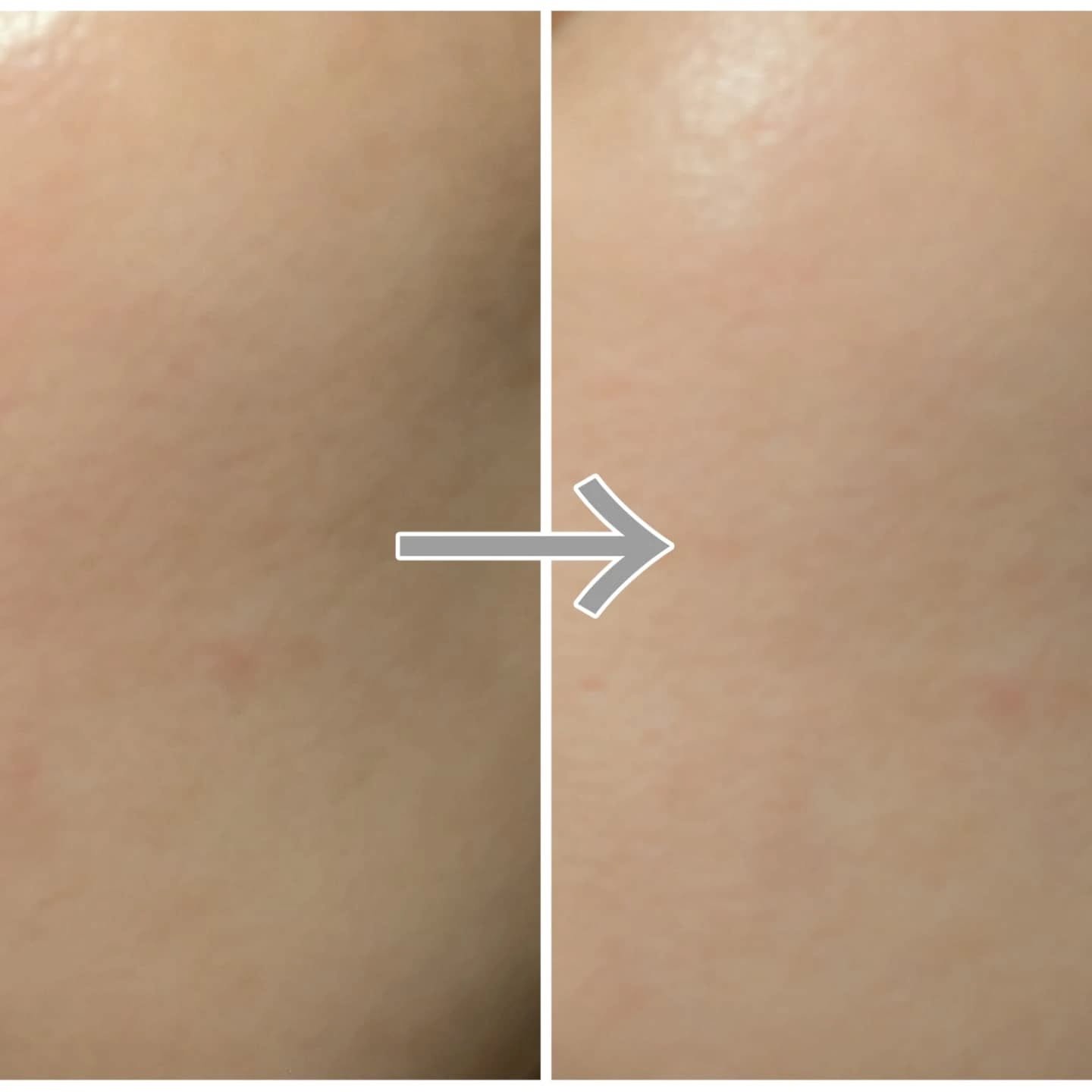 アレンシアフレッシュもちソープ「ロイヤルローズヒップ」/アレンシア/その他洗顔料を使ったクチコミ（3枚目）