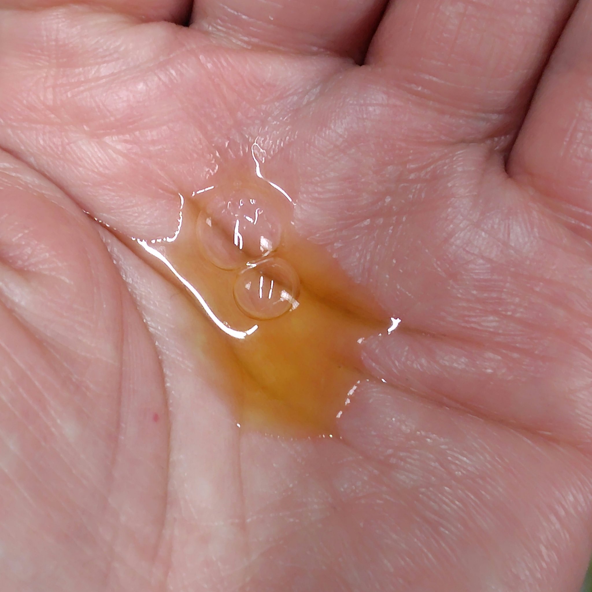 タカミ エッセンス5C+E/タカミ/美容液を使ったクチコミ（3枚目）