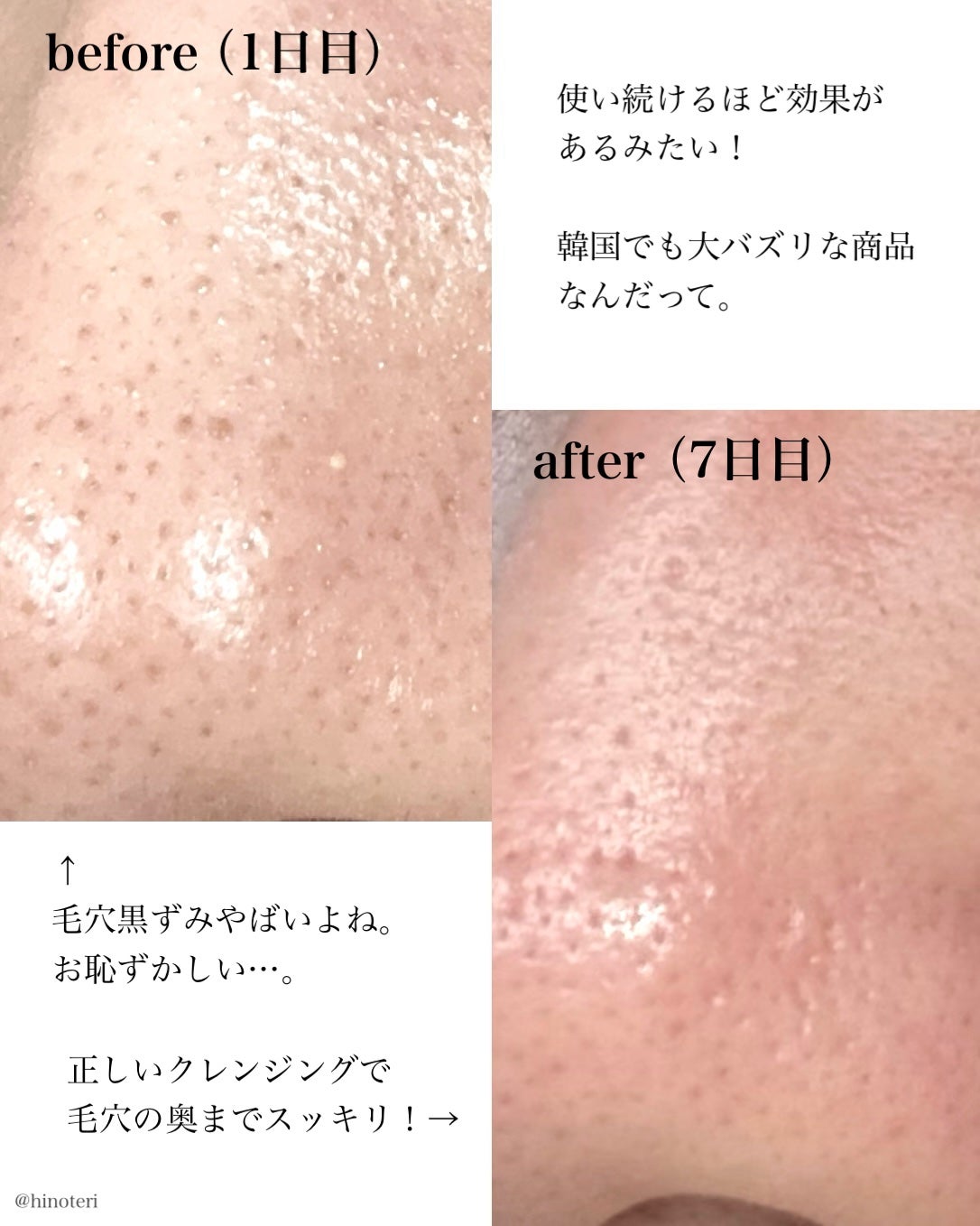 アレンシアフレッシュもちソープ「ロイヤルローズヒップ」/アレンシア/その他洗顔料を使ったクチコミ(2枚目)