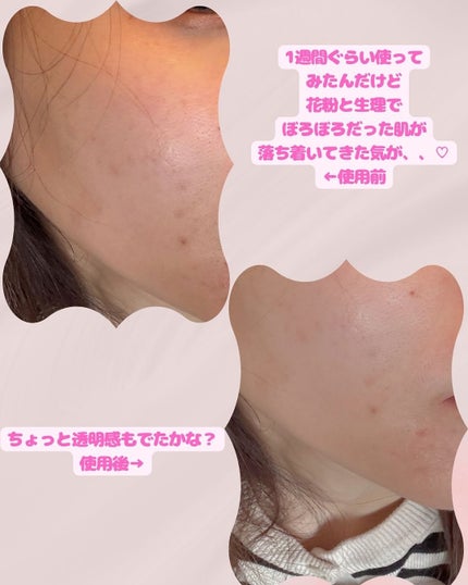 を使ったクチコミ(3枚目)