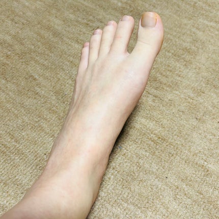 リードルショット リッチフットマスク/VT/レッグ・フットケアを使ったクチコミ(5枚目)