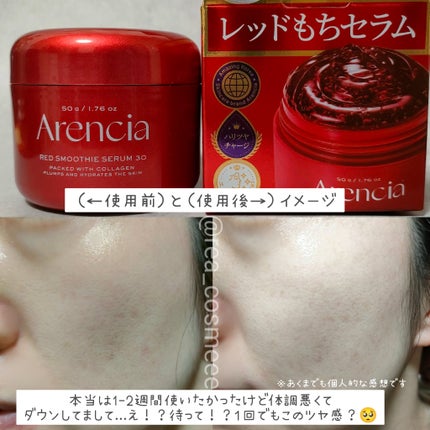 レッドモチセラム30/アレンシア/美容液を使ったクチコミ(4枚目)