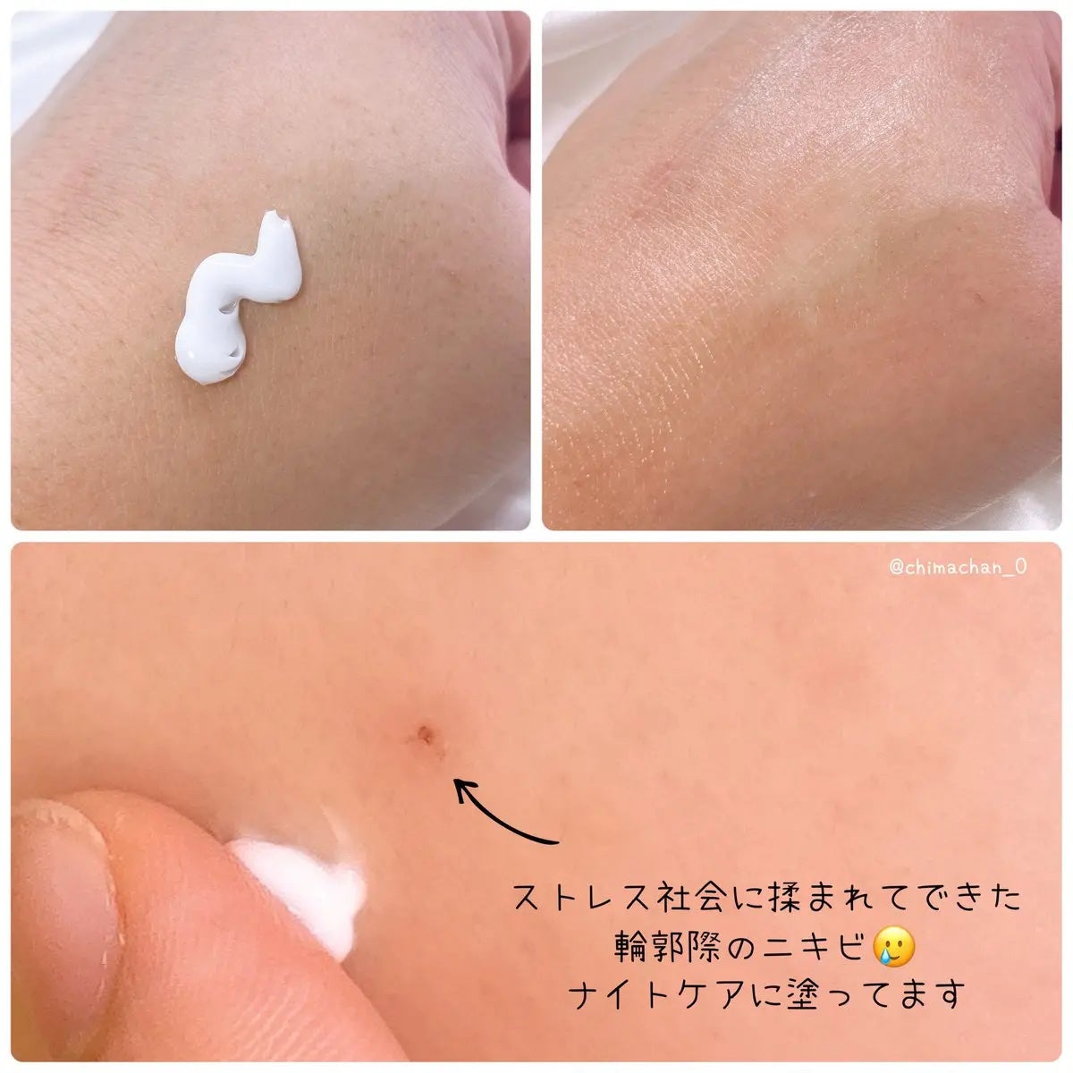 LASER REJUVENATION CREAM/Cell Fusion C(セルフュージョンシー)/フェイスクリームを使ったクチコミ(2枚目)