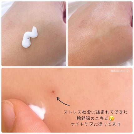 LASER REJUVENATION CREAM/Cell Fusion C(セルフュージョンシー)/フェイスクリームを使ったクチコミ(2枚目)