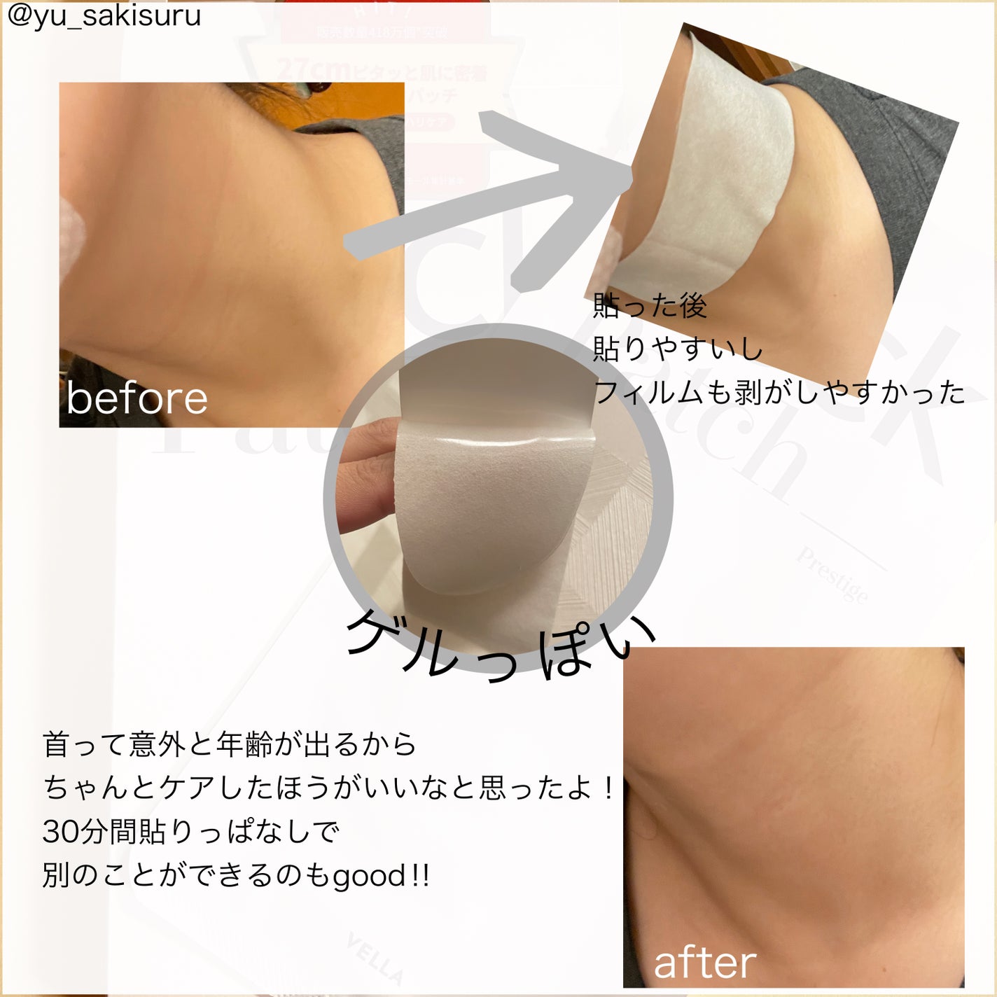 ベラ ネックパッチ/VELLA/シートマスク・パックを使ったクチコミ(2枚目)