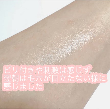 ãšãã¡ã¯ã© ããŒã«ã±ã¢ ã»ã©ã /ã© ããã·ã¥ ããŒ/çŸå®¹æ¶²ã䜿ã£ãã¯ãã³ãïŒ6æç®ïŒ