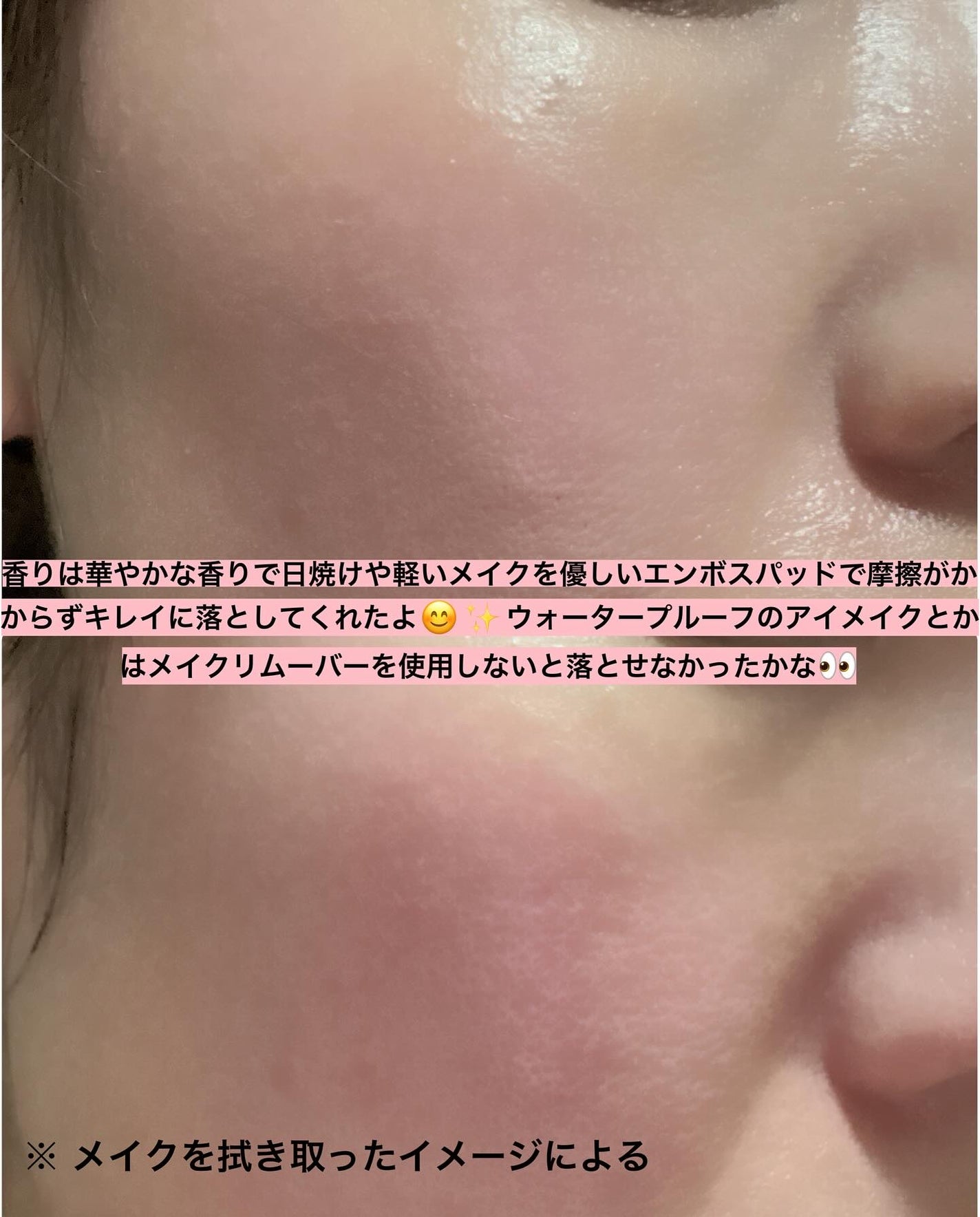 ローズ&ティーツリークレンジングパッド/VERAMORE/クレンジングシートを使ったクチコミ(5枚目)