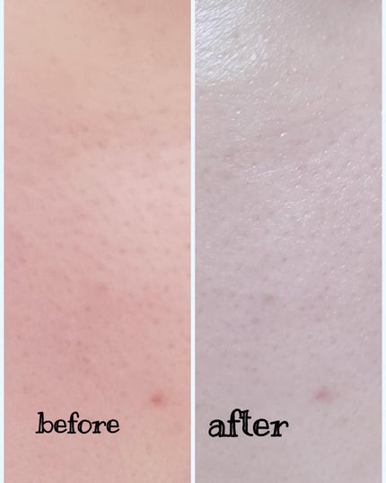 アレンシアフレッシュもちソープ「ロイヤルローズヒップ」/アレンシア/その他洗顔料を使ったクチコミ(6枚目)