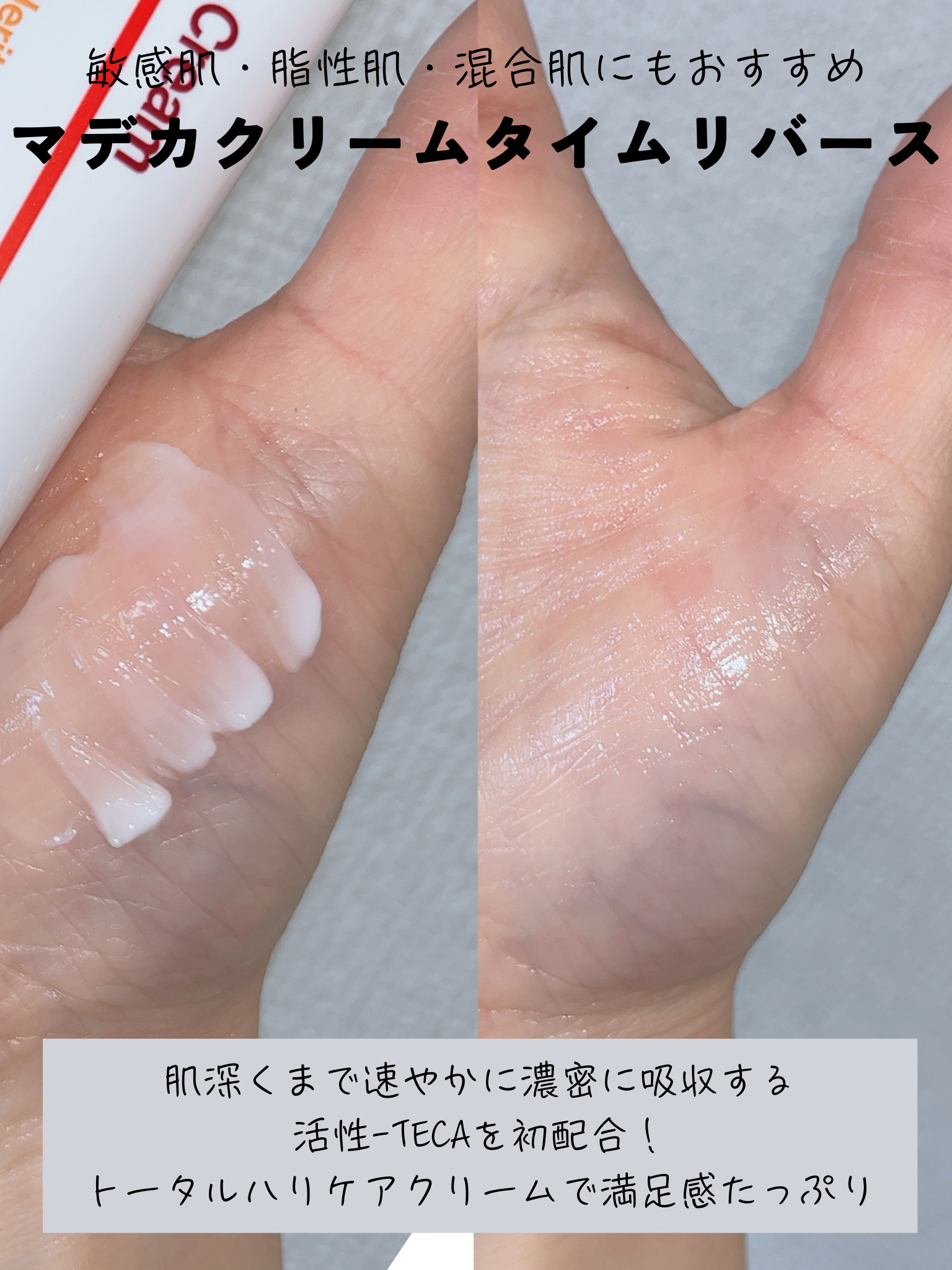 ザマデカクリーム/センテリアン24/フェイスクリームを使ったクチコミ（3枚目）