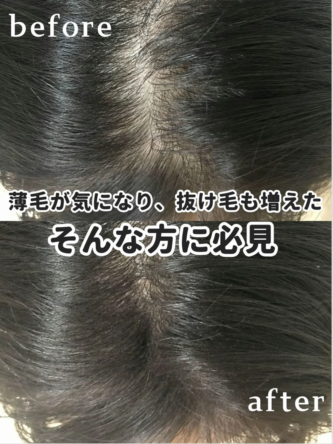 黒ツヤソフト/和漢SINCA/美容サプリメントを使ったクチコミ（1枚目）