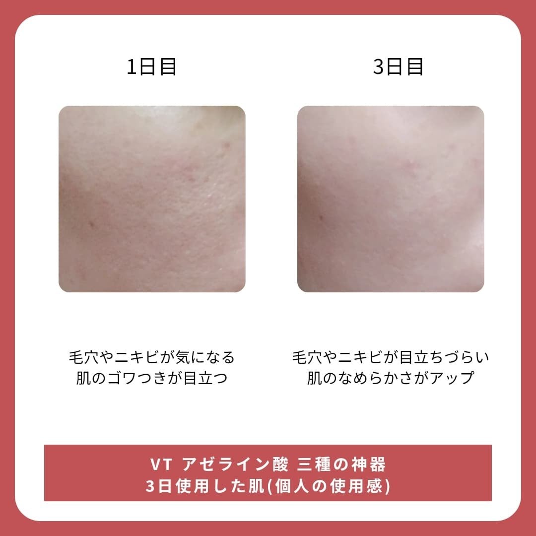 A1カーミング アンプル/VT/美容液を使ったクチコミ(4枚目)