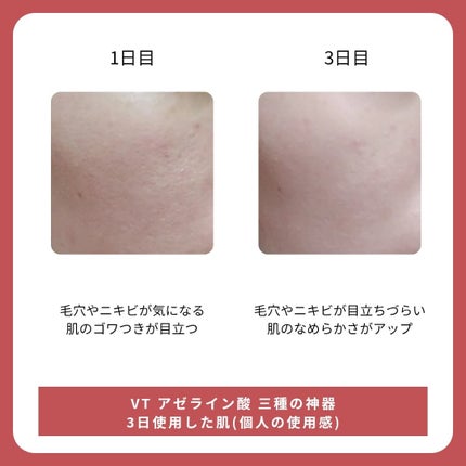 A1カーミング アンプル/VT/美容液を使ったクチコミ(4枚目)