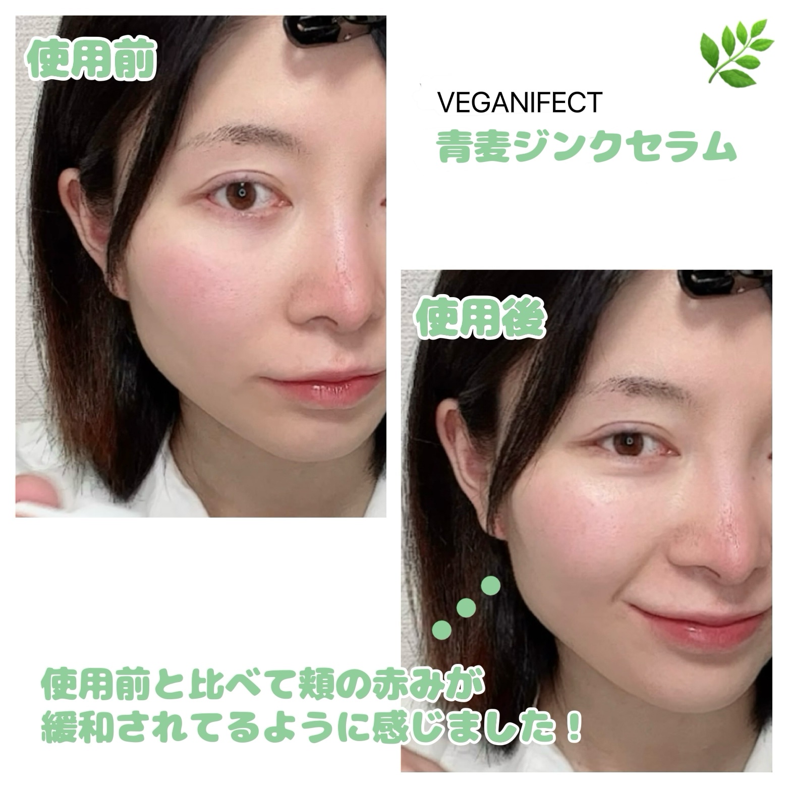 青麦ジンクセラム/Veganifect/美容液を使ったクチコミ（2枚目）