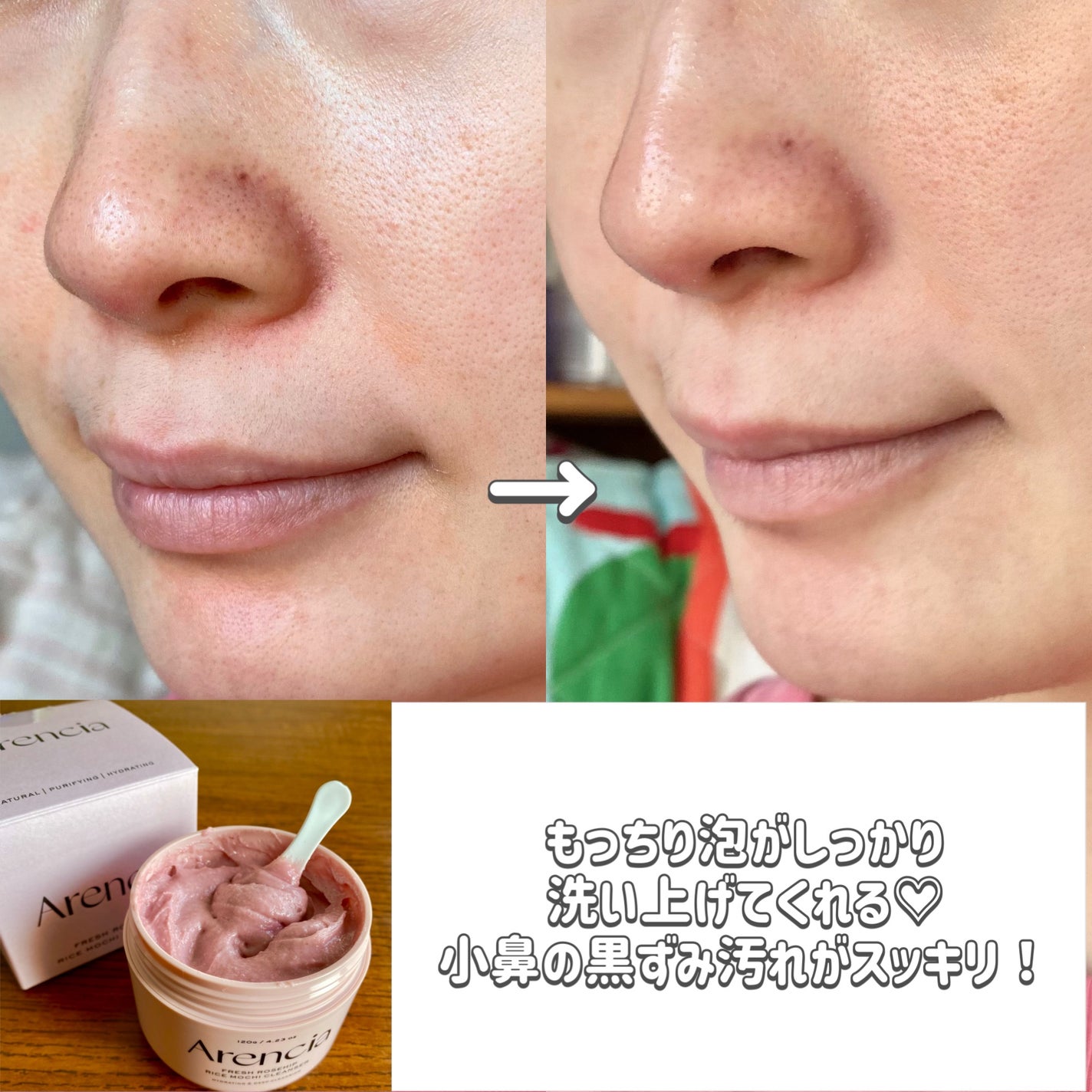 アレンシアフレッシュもちソープ「ロイヤルローズヒップ」/アレンシア/その他洗顔料を使ったクチコミ(2枚目)