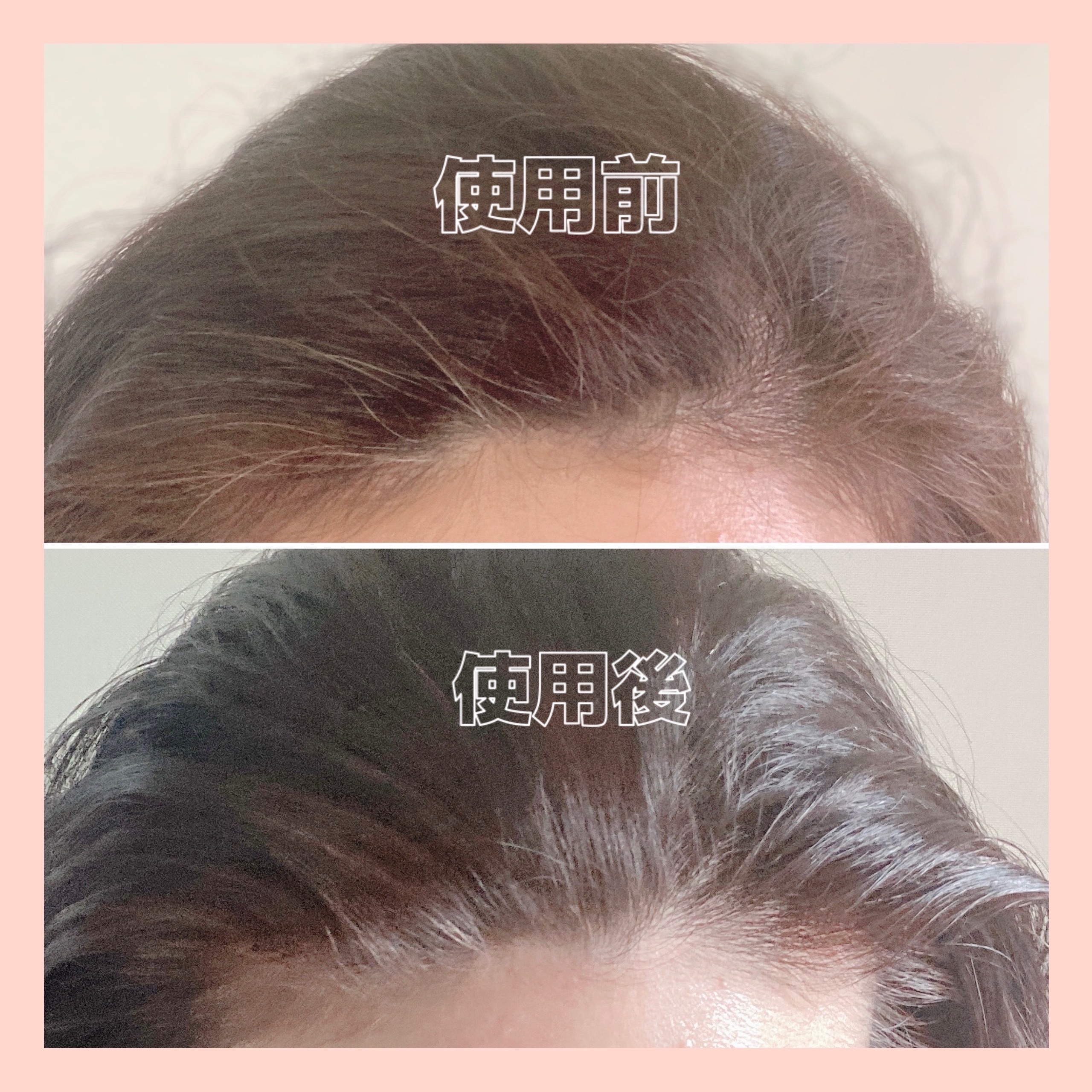 泡クリームカラー/ビゲン/ヘアカラーを使ったクチコミ（3枚目）