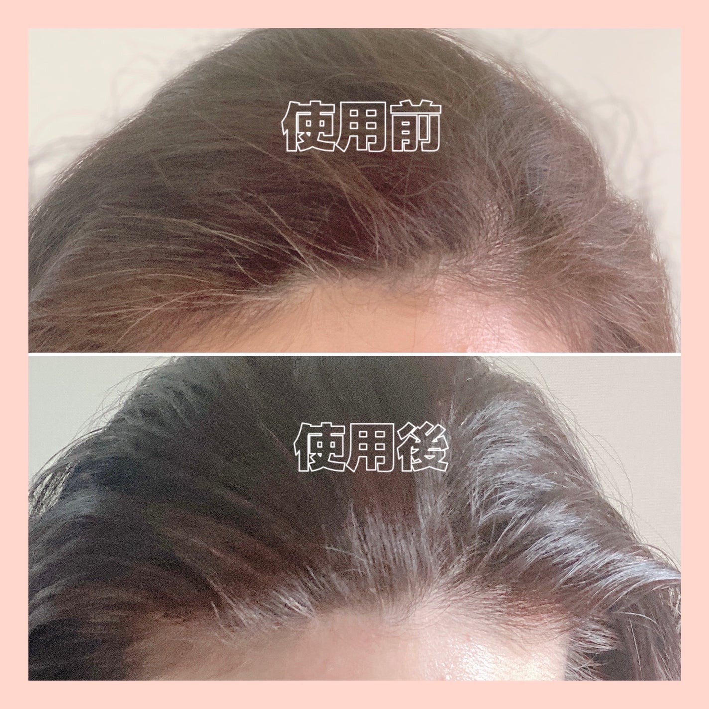 泡クリームカラー/ビゲン/ヘアカラーを使ったクチコミ(3枚目)